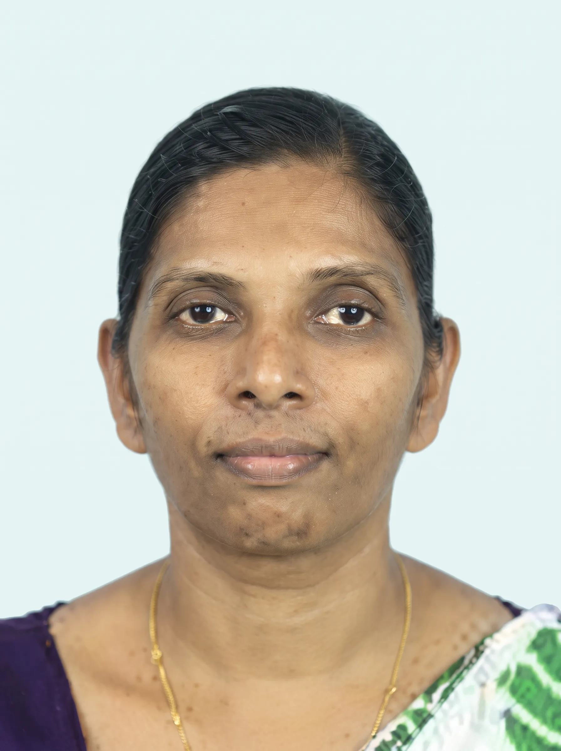 Ms. U. W. N. J. Gunathunga